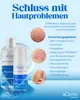 Blueline Creme Lotion zur Hautpilz, Fußpilz, Ekzem oder Produktbild-Vorschau 7