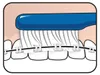 TePe Implant/Ortho Zahnbürste 1 Stück Produktbild-Vorschau 26