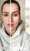 Rosental EMS Gua Sha-Gesichtsmassagegerät für alle Produktbild-Vorschau 6