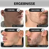 Anthony Brown Bartwuchs Set mit Bartroller 0,5 mm, Serum Produktbild-Vorschau 6