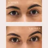 Cintas PARSA Beauty Lifestyle para corrección de párpados Vista previa de la imagen del producto 4