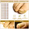 Eingewachsene Zehennägel Set 120 Stück Zehennagel Korrektur Produktbild-Vorschau 3