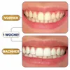 Lumineux Teeth Whitening Strips - 42 pièces - Bandelettes Voir les images du produit 3