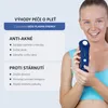 Vysokofrekvenční přístroj se studenou plazmou – proti Náhled obrázku produktu 3