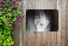 MuchoWow® 60x40 cm Outdoor-Poster Gartendeko Sichtschutz Produktbild-Vorschau 5