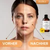 St John'S Wort Oil, Johanniskrautöl, 100% Rein, BIO, Produktbild-Vorschau 3