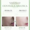 iUNIK Centella Calming Gel Cream, 60ml - Beruhigende und Produktbild-Vorschau 7