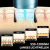 IPL Haarentfernungsgerät 999.999 Lichtimpulse 5 Stufen Produktbild-Vorschau 3