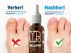 MALUFIN® Nagelbalsam – Tiefenpflege der Nagelmatrix | Produktbild-Vorschau 5