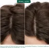 Biolage Professional Hai Spa Scalp Sync Anti-Dandruff Anteprima dell’immagine prodotto 4