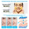 Kurkuma Turmeric Cleansing Pads Reinigungspads Gesichtspads Produktbild-Vorschau 5