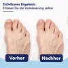 Paremmin Nagelpilzpflaster 36 Stück – gegen Zehennagelpilz Produktbild-Vorschau 4