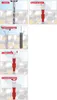 TOX-Stand-WC-Befestigung Toilet Produktbild-Vorschau 9