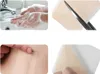 INF Strisce di silicone per cicatrici - 2 rotoli di nastro Anteprima dell’immagine prodotto 4