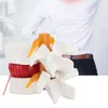 1:1.5 Lékařský demonstrační model bederní páteře Model Náhled obrázku produktu 5