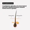 Loreal Serie Expert Scalp Advanced ANTI-Pelliculaire šampón Náhľad obrázku produktu 14
