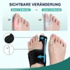Hallux Valgus Korrektur Orthese,Zehenspreizer mit Produktbild-Vorschau 2