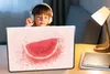 MuchoWow® Laptop Aufkleber Sticker Cover Wassermelone - Produktbild-Vorschau 3