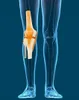 Anatomický model kostry, model kolenního kloubu, výukové Náhled obrázku produktu 5