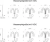 Diagrams showing water spray sizes for different voltage inputs. Produktbild-Vorschau