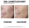 Vichy Normaderm Phytosolution, unisex, para piel mixta, Vista previa de la imagen del producto 16