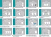 A collage of 16 diagrams illustrating different solar heating system configurations. Produktbild-Vorschau