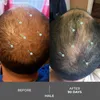 Shampoing, DS Laboratories, Revita, formule renforcée, pour Voir les images du produit 9