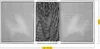 Moustiquaire Extensible Schellenberg Protection Modulable Voir les images du produit 6
