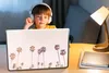 MuchoWow® Laptop Aufkleber Sticker Cover Palmen - Sonne - Produktbild-Vorschau 3