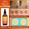 LUMINER Siero Vitamina C 100ml, Siero Viso Acido Anteprima dell’immagine prodotto 9