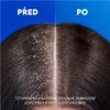 A split image showing a comparison of a scalp before and after using a product, with text indicating the difference. Podgląd zdjęcia produktu