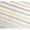 A close-up view of various decorative stitches created by a sewing machine on white fabric. Náhľad obrázku produktu