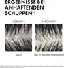 Vichy Dercos Refill Anti-Dandruff Shampoo Dry Hair 500ml Produktbild-Vorschau 4