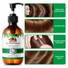 Shampoo Batana mit Rosmarin Haarwachstum Kopfhaut Pflege Produktbild-Vorschau 8