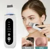 Appareil de gommage à ultrasons Nettoyeur de pores visage Voir les images du produit 2