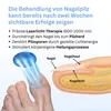 Nagelzubehör, Nagelpilz Reinigungslampe, Nagelpilz Laser Produktbild-Vorschau 4