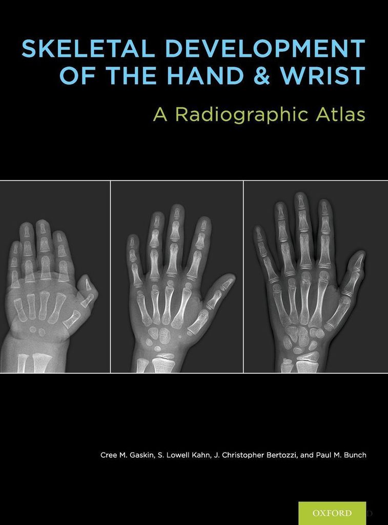 Skel Develop Hand & Wrist Bk & Dvd Pck