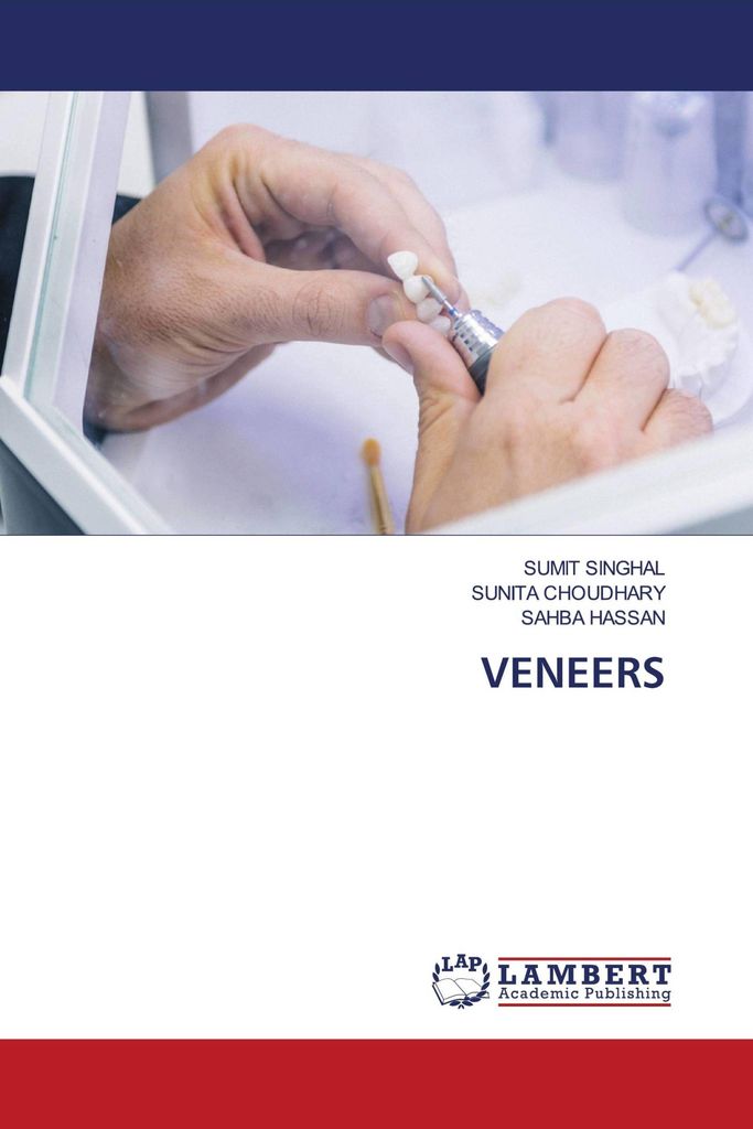 Veneers