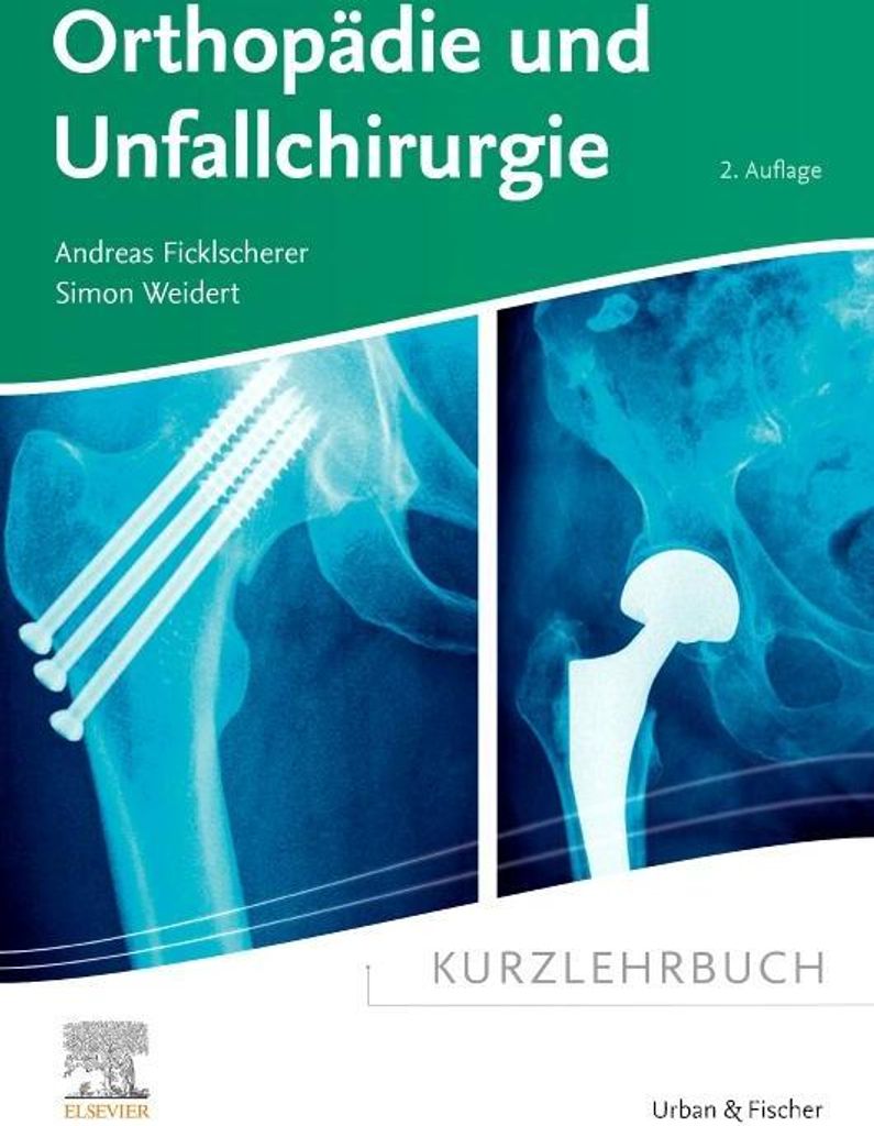 Kurzlehrbuch Orthopädie und Unfallchirurgie