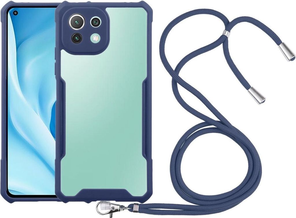 König Design Hülle kompatibel mit Xiaomi Mi 11 Lite Produktbild 