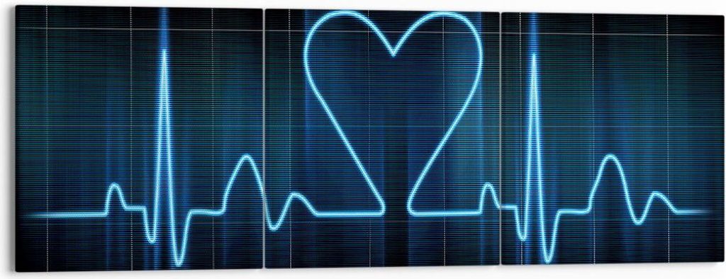 Bild auf Leinwand - Leinwandbild - Grafik herz kardiologie - 150x50cm - Wand Bild - Wanddeko - Leinwanddruck - Bilder - Kunstdruck - Wanddekoration...