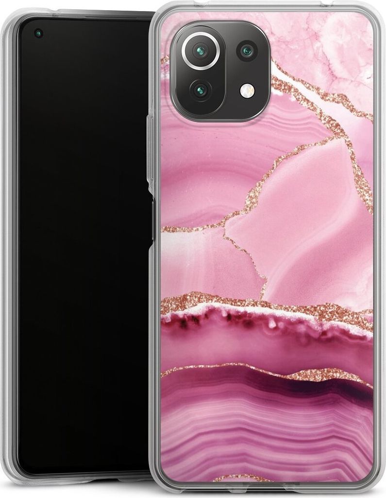 DeinDesign Handyhülle für Xiaomi Mi 11 Lite 5G NE Silikon Hülle Case Smartphone Schutzhülle Glitzer Look Marmor Meerjungfrau