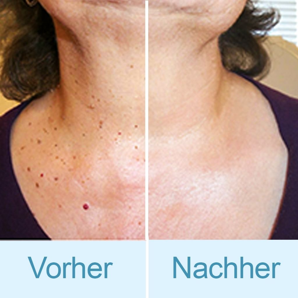 Thuja Skincare-Fluid, 10ml mit Dosierpinsel Gesichtscremes