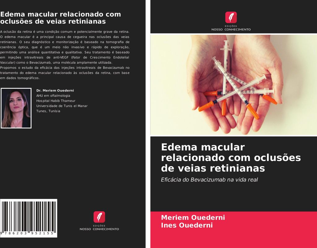 Edema macular relacionado com oclusões de veias retinianas