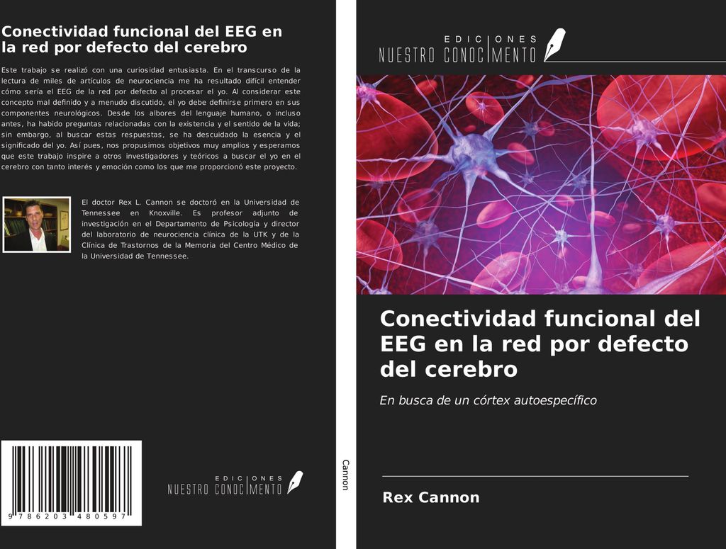Conectividad funcional del EEG en la red por defecto del cerebro