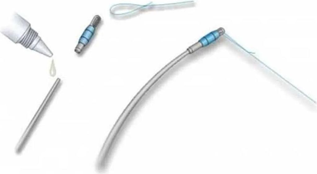 Stonfo Connettore apicale argento 2,00 mm argento 2,00 mm Immagine del prodotto 