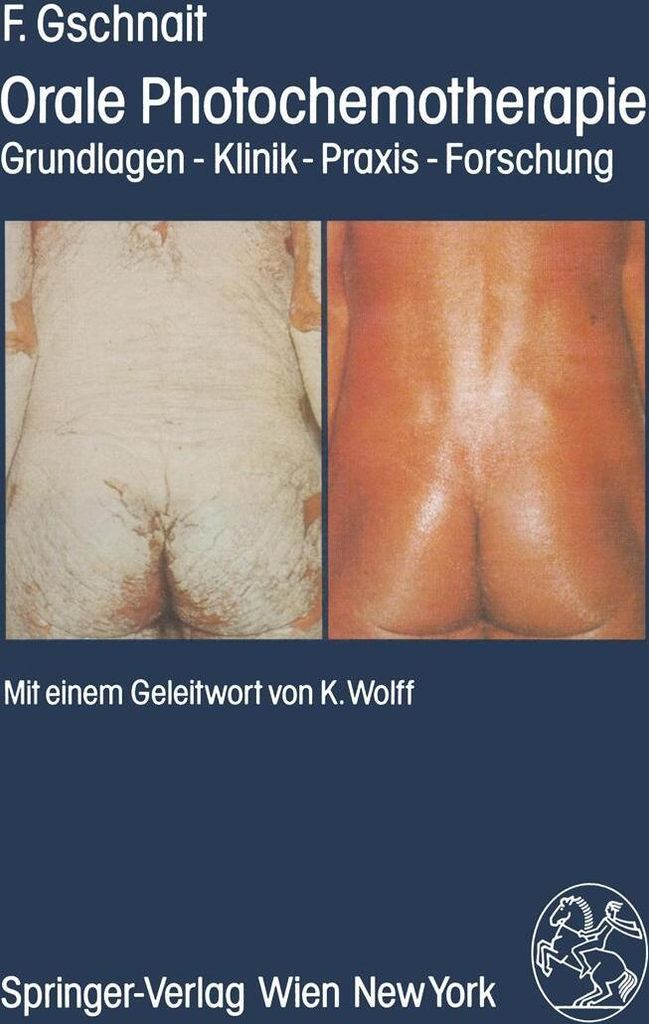 Orale Photochemotherapie