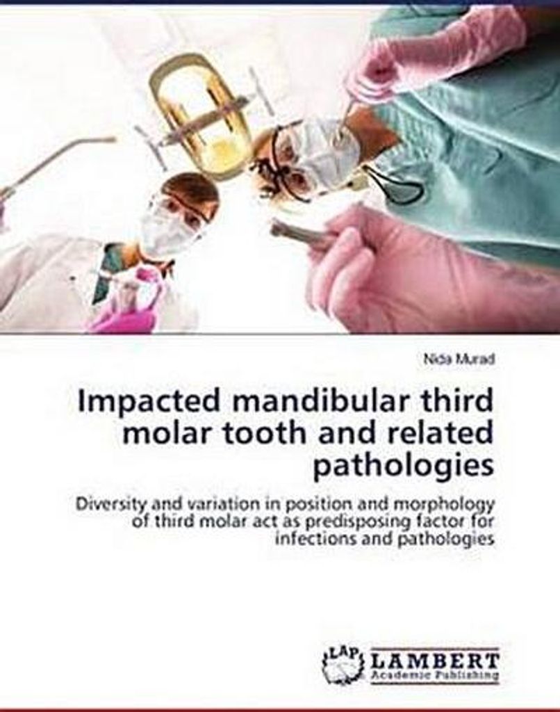 Impacted mandibular third molar tooth and related pathologies
