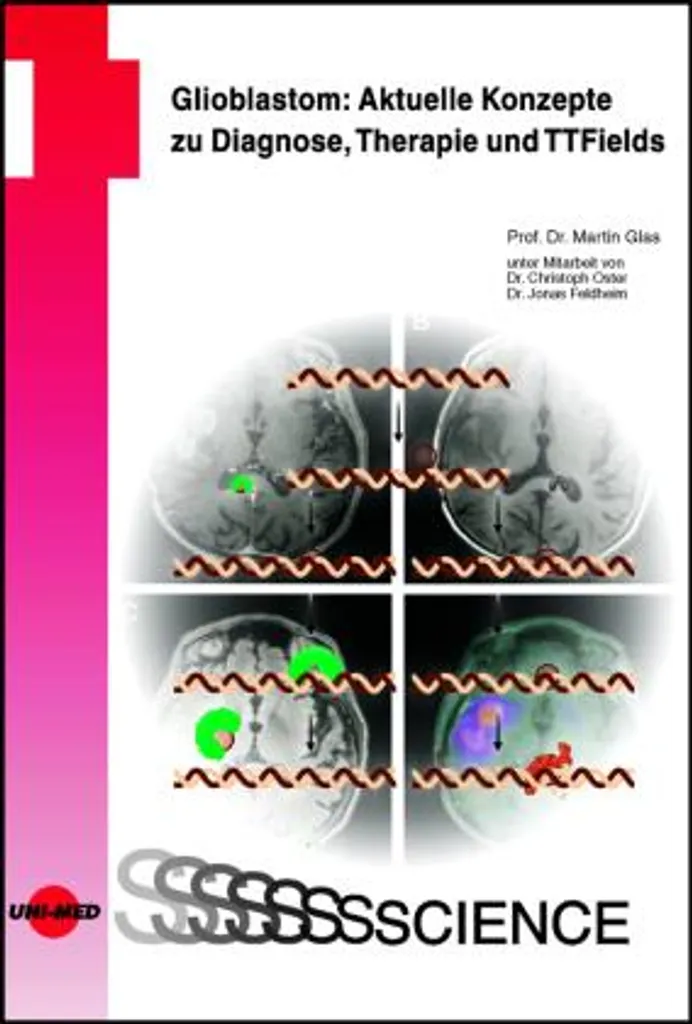 Glioblastome : Solutions Thérapeutiques et TTFields pour Praticiens - 2