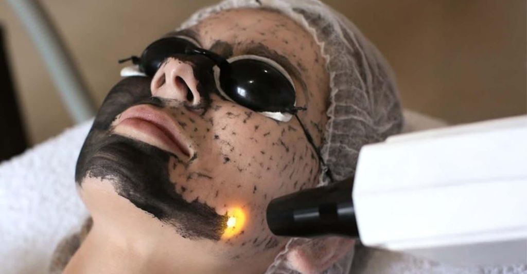 mydays Carbon Peeling München; Erlebnis verschenken oder selbst erleben; Gutschein für 1 Person(en)